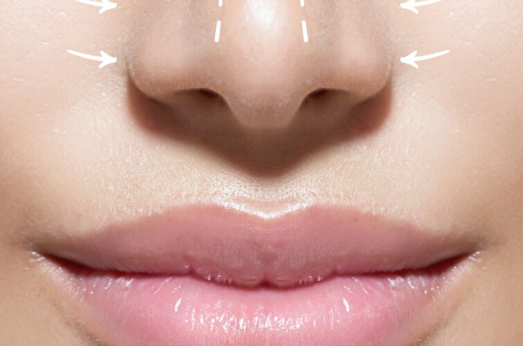 la Rhinoplastie : affiner le nez