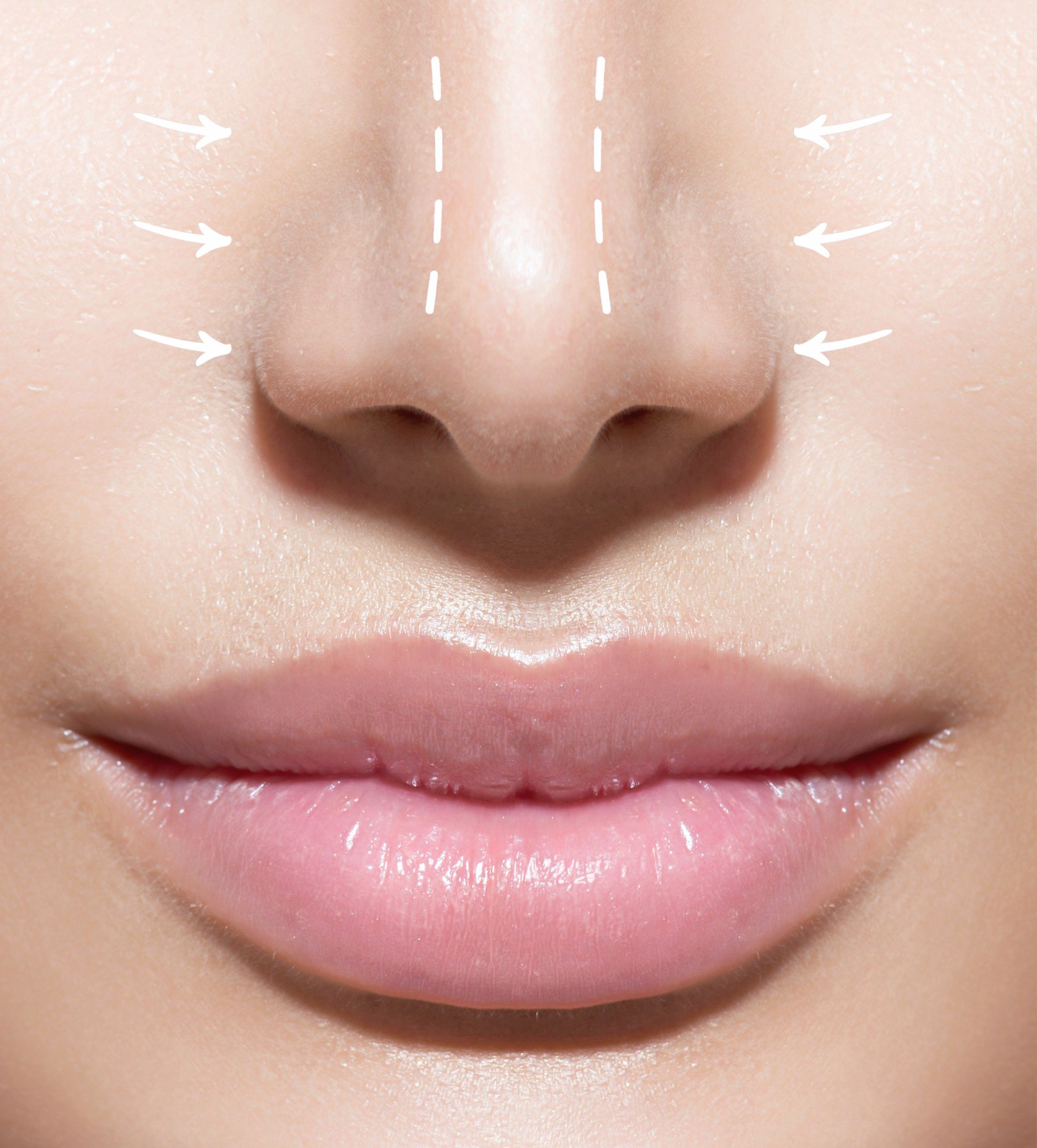 la Rhinoplastie : affiner le nez