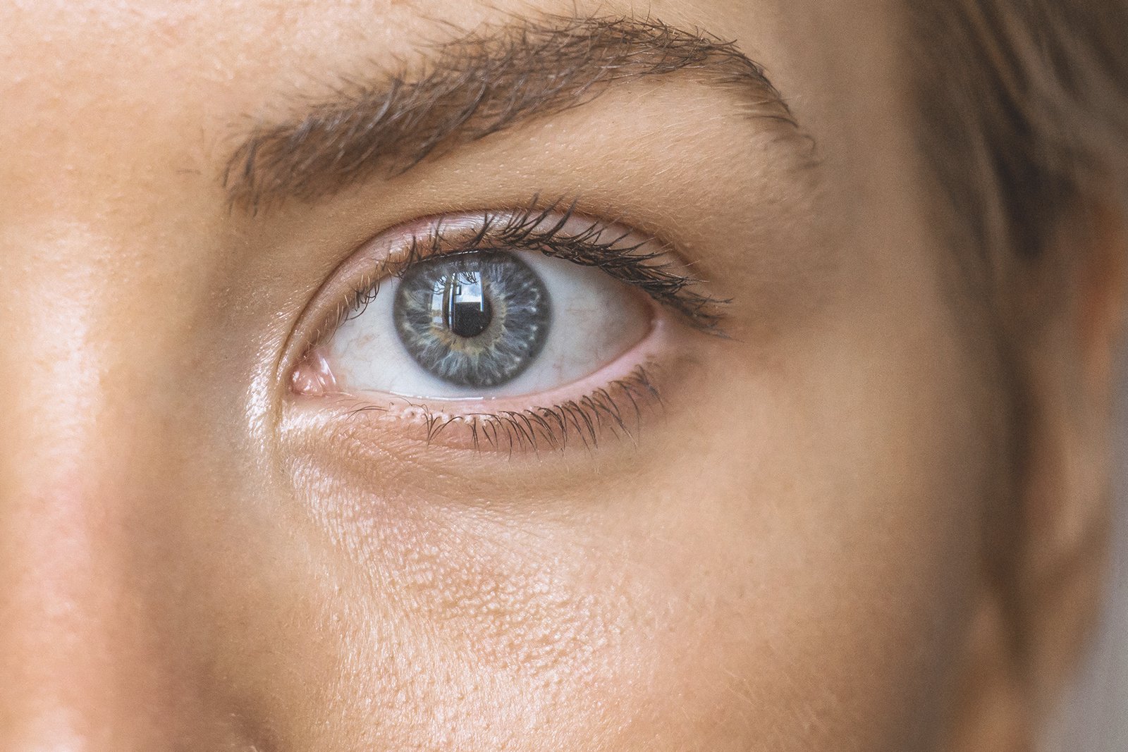 Paupière lisse et regard lumineux après c une blépharoplastie en Tunisie