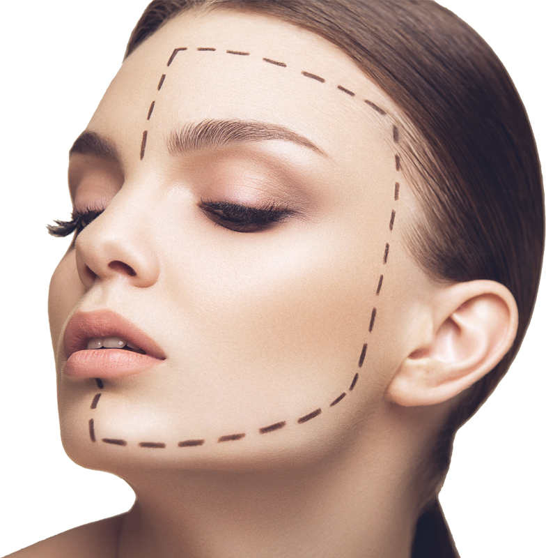 lifting du visage