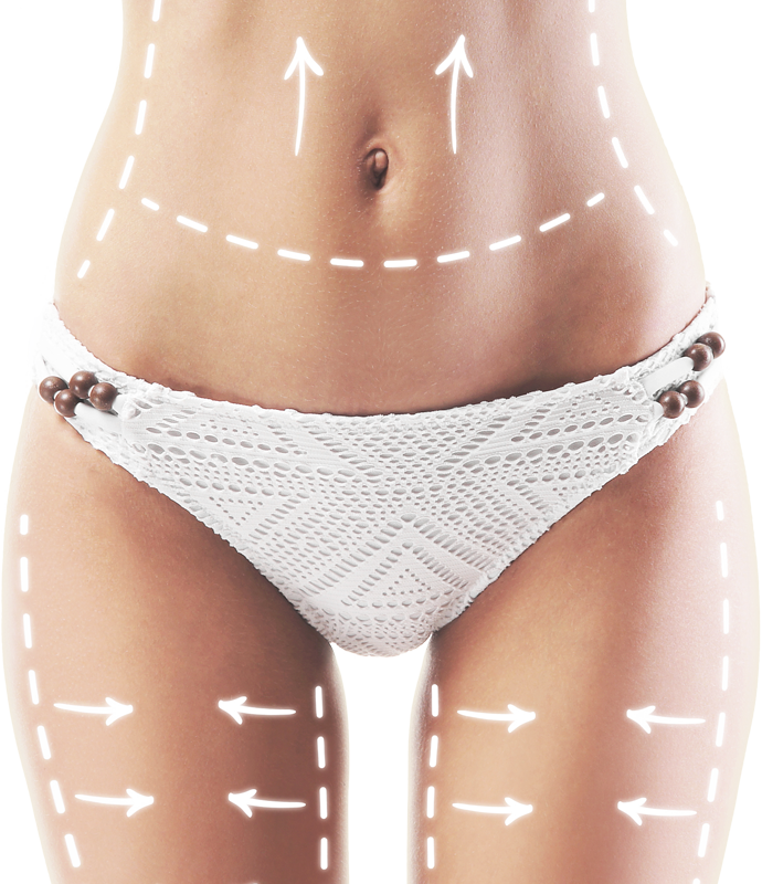 Abdominoplastie Tunisie