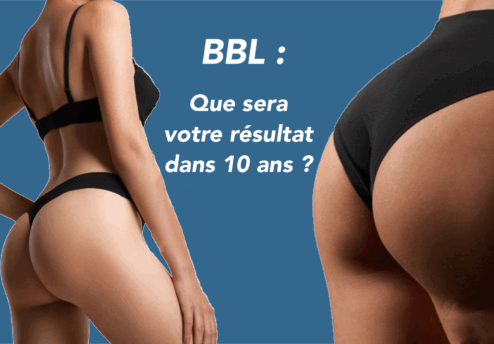 "Résultat BBL 10 ans après avant et après"
