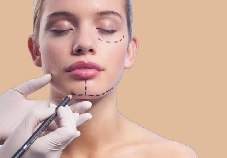 Séjour esthétique en Tunisie : visage féminin avec traçage pré-opératoire pour chirurgie esthétique