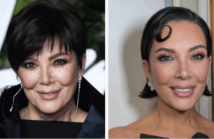 Lifting visage Kris Jenner
