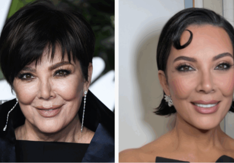 Lifting visage Kris Jenner