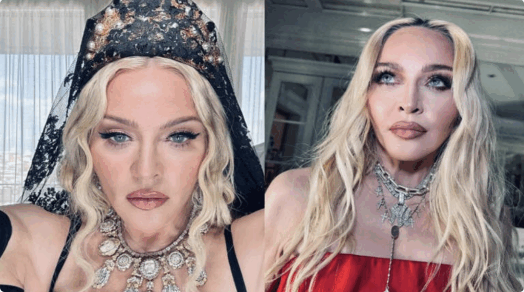 Madonna 2025 après lifting visage