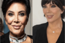 kris Jenner avant et après