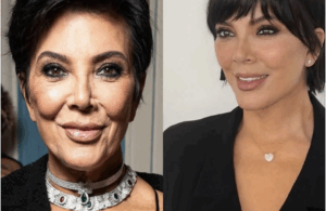kris Jenner avant et après