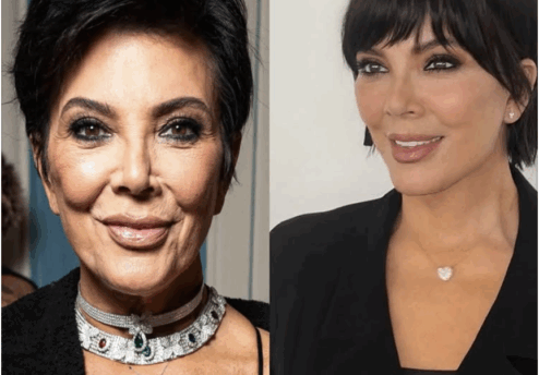 kris Jenner avant et après