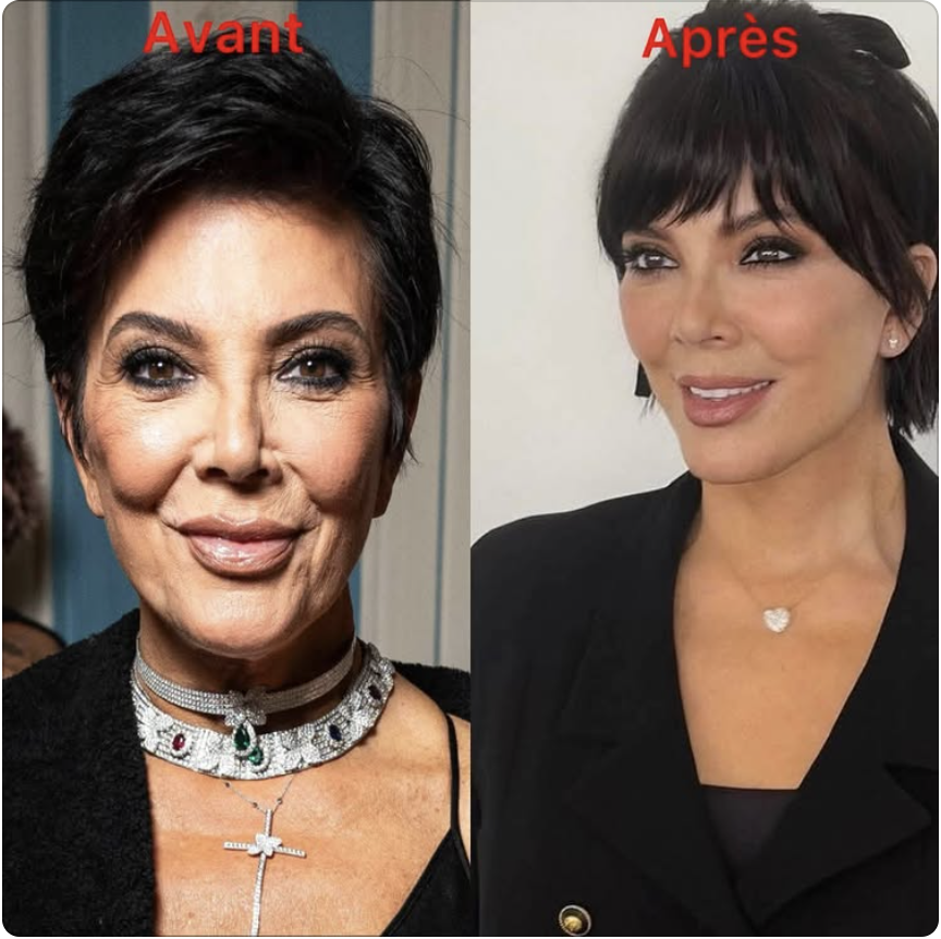 kris Jenner avant et après