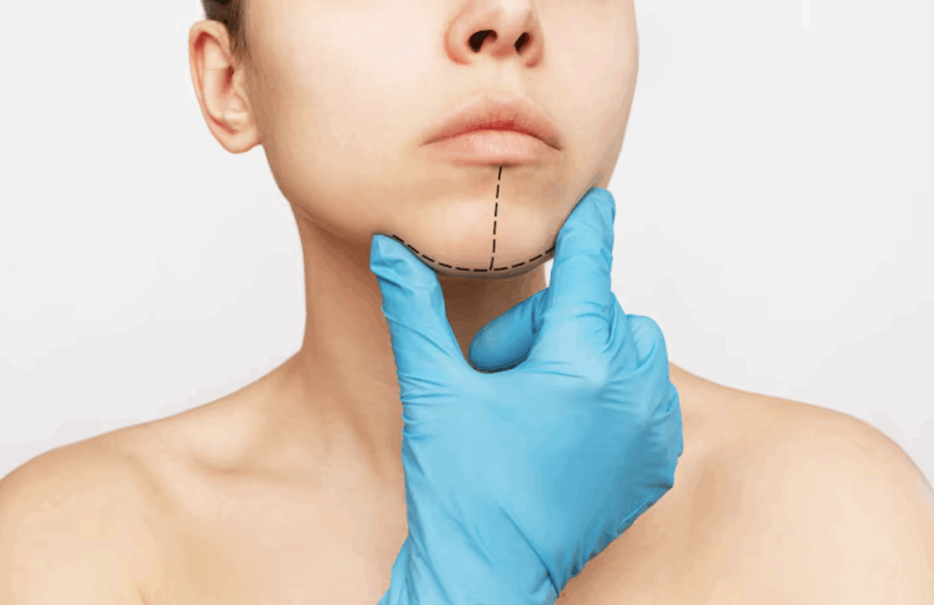 La Génioplastie : chirurgie du menton avec Silhouette Esthetics