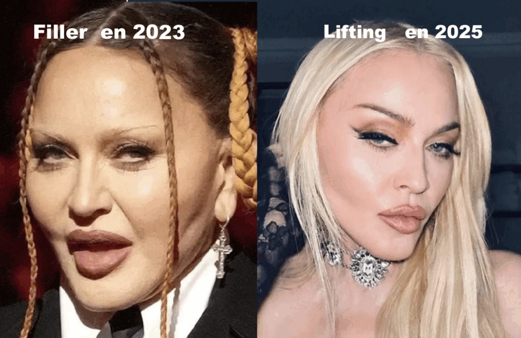 Madonna avant et apres