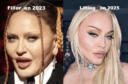 Madonna avant et apres