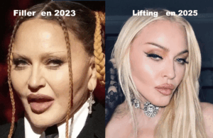 Madonna avant et apres