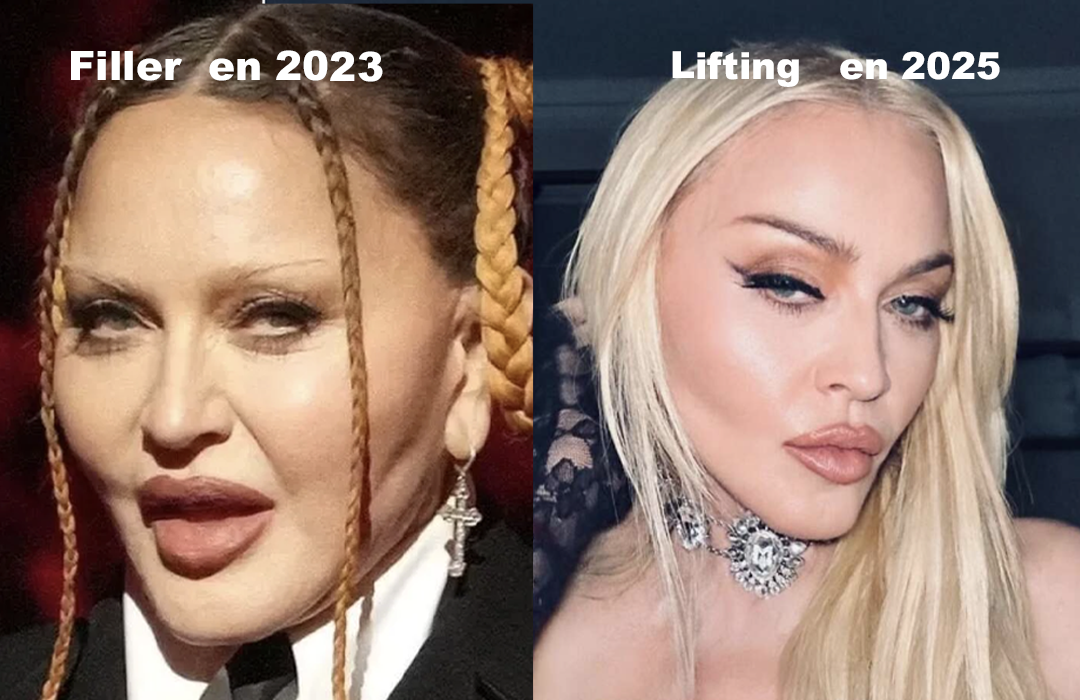Madonna avant et apres