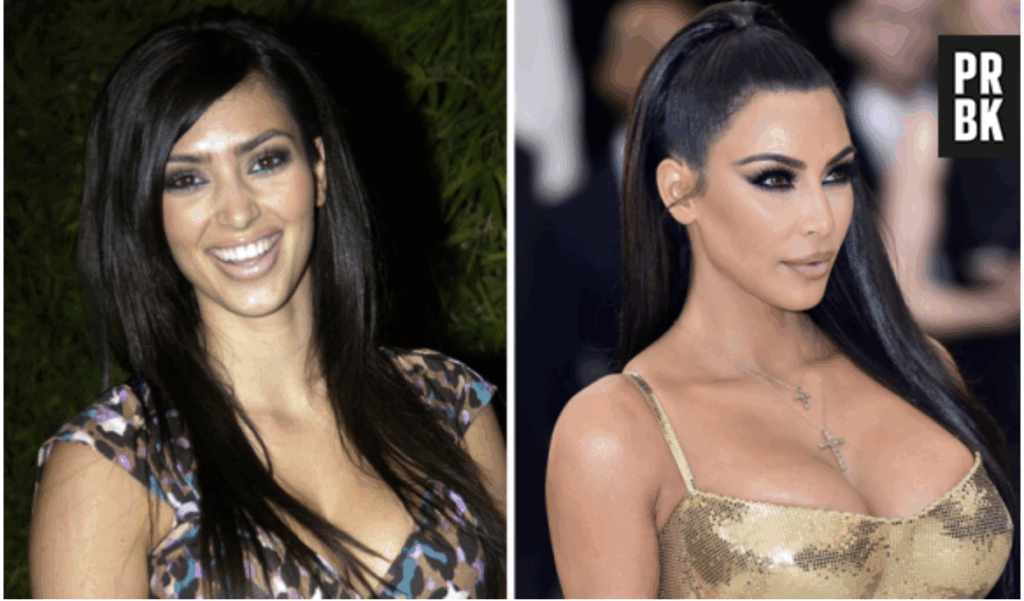 Photos avant et après du visage de Kim Kardashian