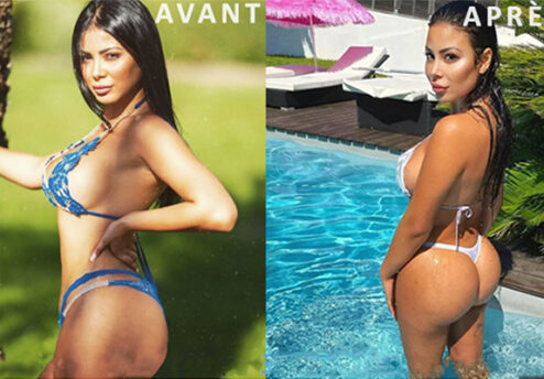 Maeva Ghennam bbl avant et après