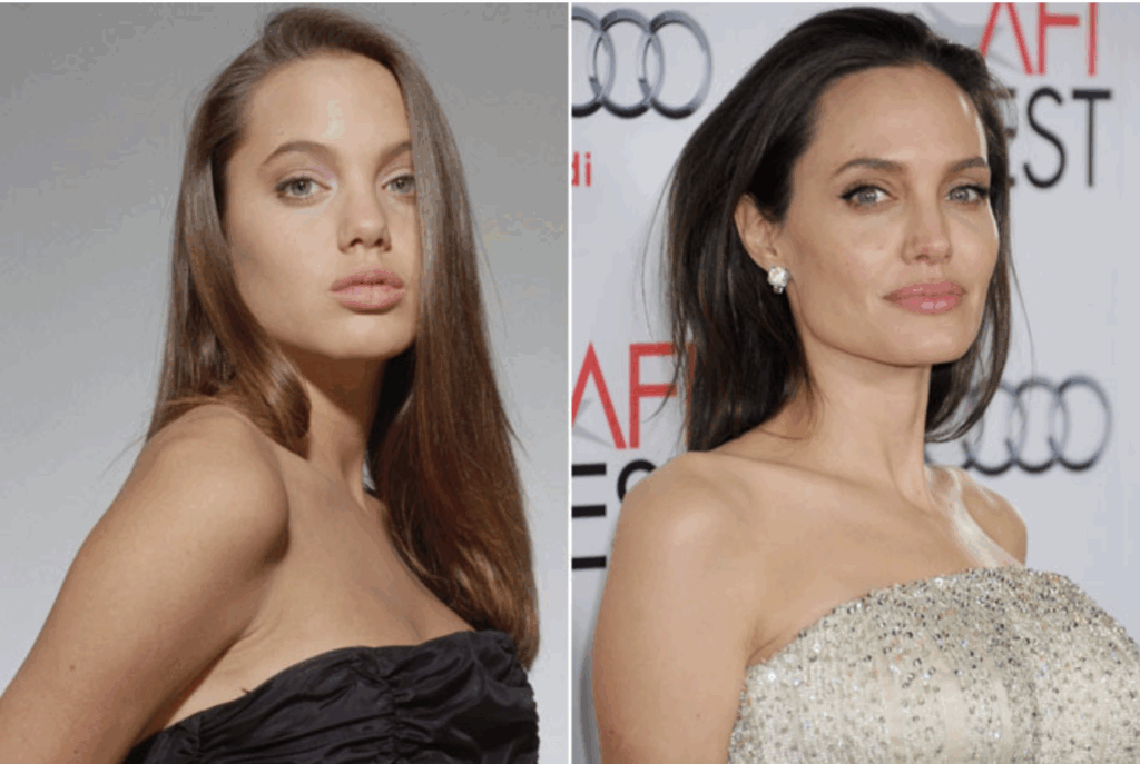 Rhinoplastie d'Angelina Jolie en photos avant et après