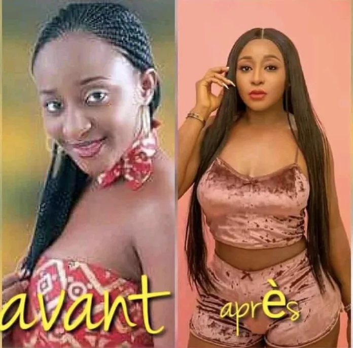 Ini Edo avant et après bbl et chirurgie du visage 