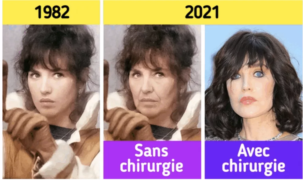 évolution du visage d'Isabelle Adjani 
