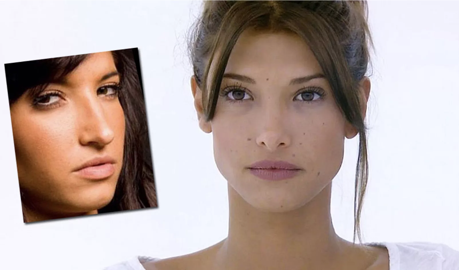 Mélanie Dedigama avant et après chirurgie esthétique