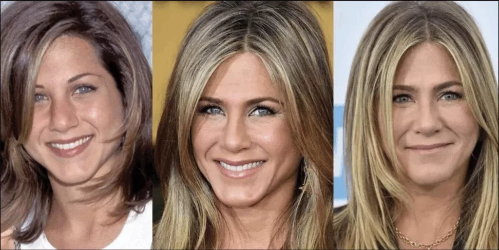 Photos de Jennifer Aniston Avant:après la Chirurgie esthétique