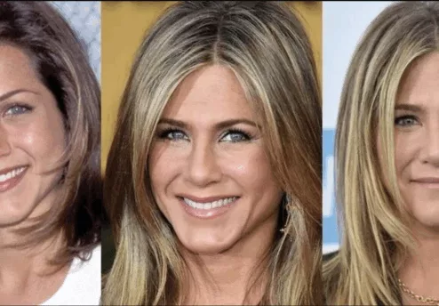 Photos de Jennifer Aniston Avant:après la Chirurgie esthétique