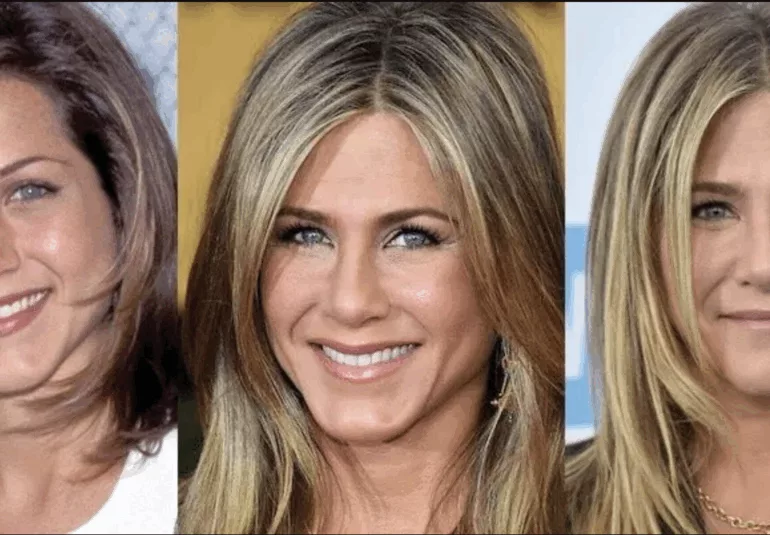 Photos de Jennifer Aniston Avant:après la Chirurgie esthétique