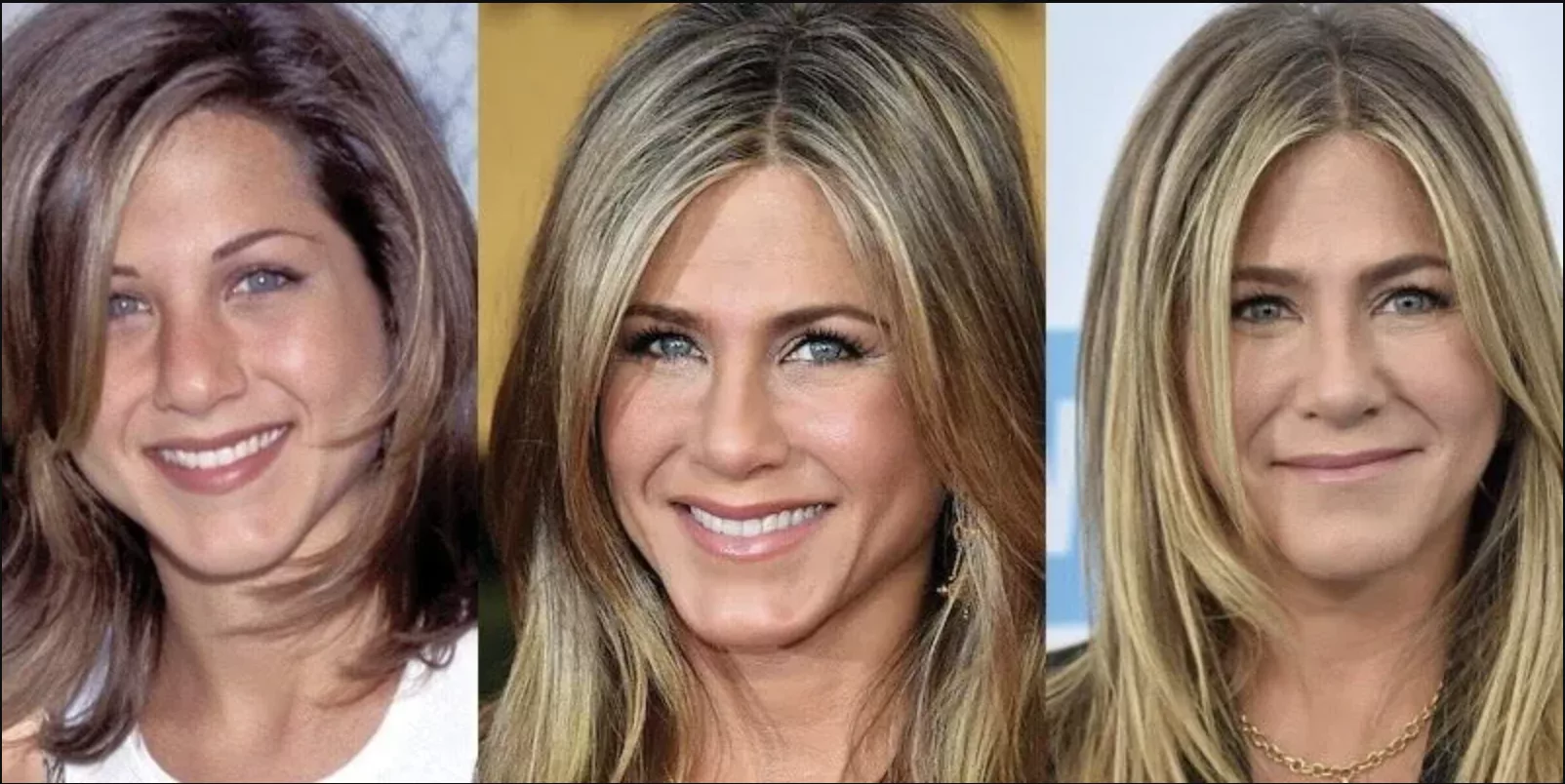 Photos de Jennifer Aniston Avant:après la Chirurgie esthétique