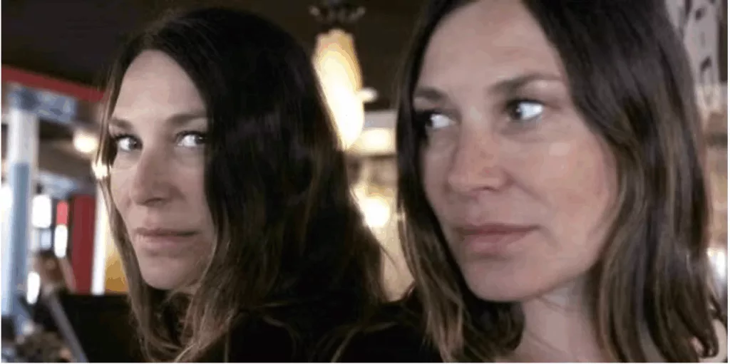 Photo de Zazie avant et après la chirurgie du nez 