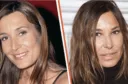 Photo de Zazie en avant et après chirurgie esthétique
